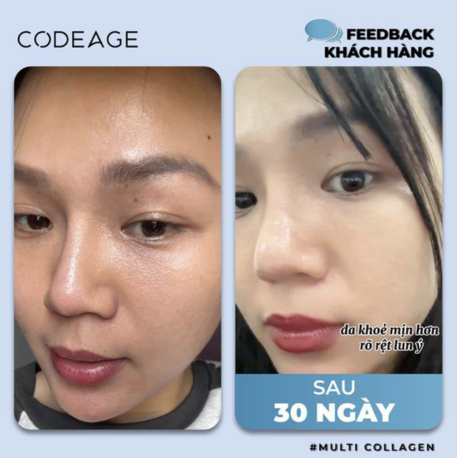 Góc giải đáp: Uống collagen dạng bột hay dạng nước tốt hơn?- Ảnh 10.