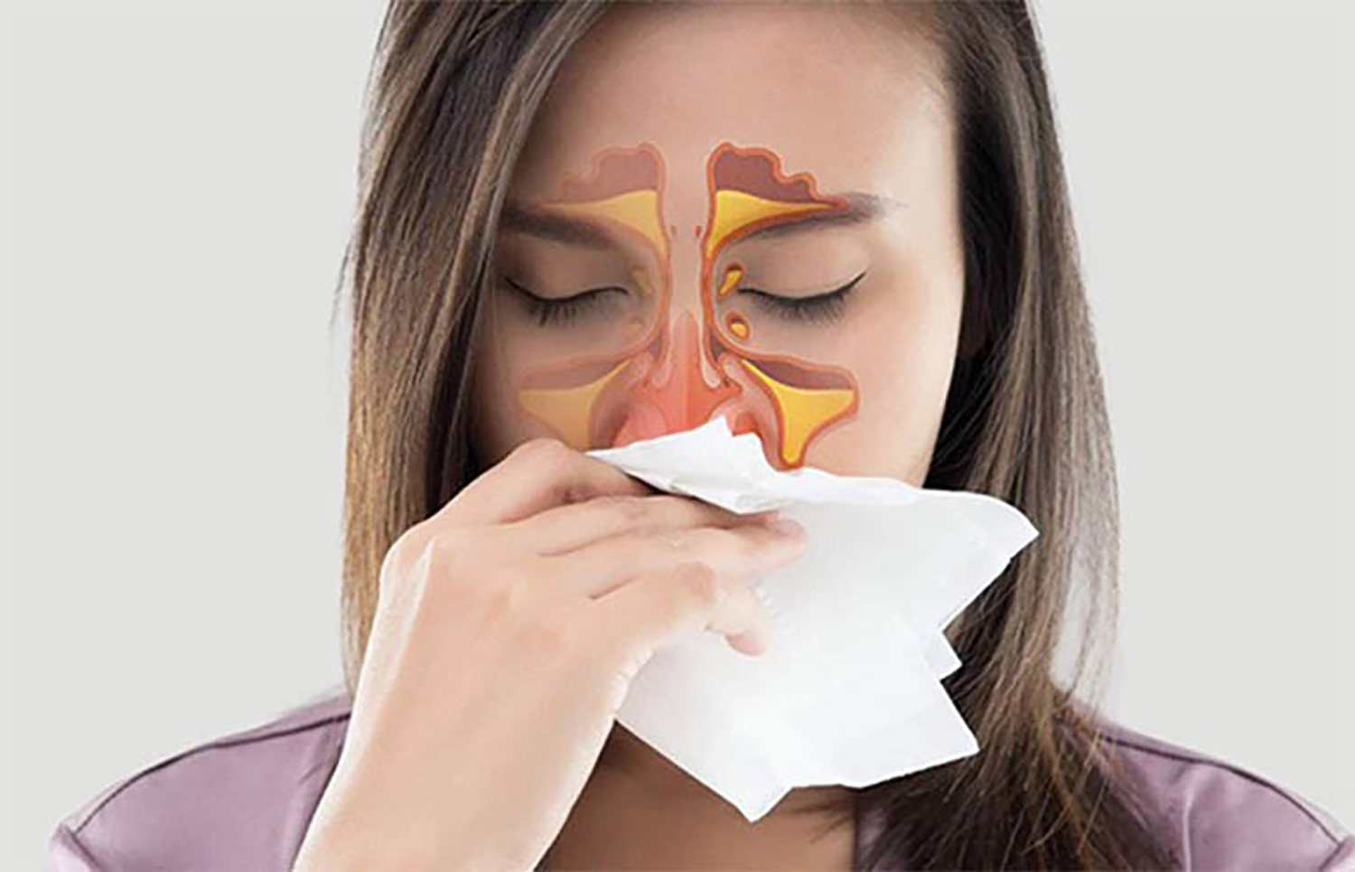 Nồm ẩm hoành hành, cúm mùa tái phát - Đừng để mình là ‘nạn nhân’ - Ảnh 2. Nồm ẩm hoành hành, cúm mùa tái phát - Đừng để mình là ‘nạn nhân’ - Ảnh 2.