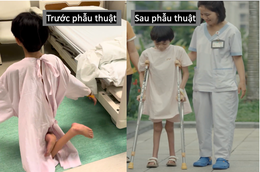 'Con chưa bao giờ được chạm bàn chân mình xuống đất như thế' - Ảnh 1.