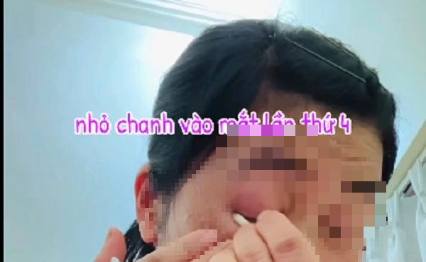 - Ảnh 2. - Ảnh 2.