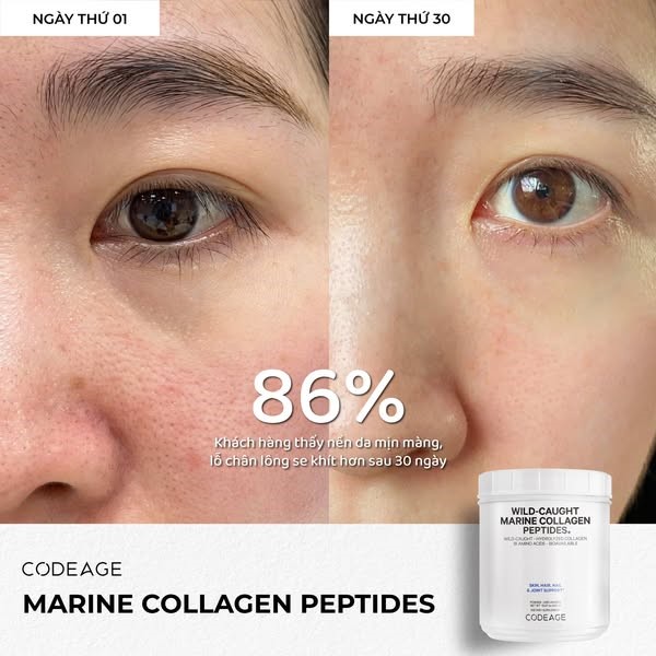 Collagen loại nào hiệu quả, dễ uống mà không nổi mụn, không tác dụng phụ?- Ảnh 5.