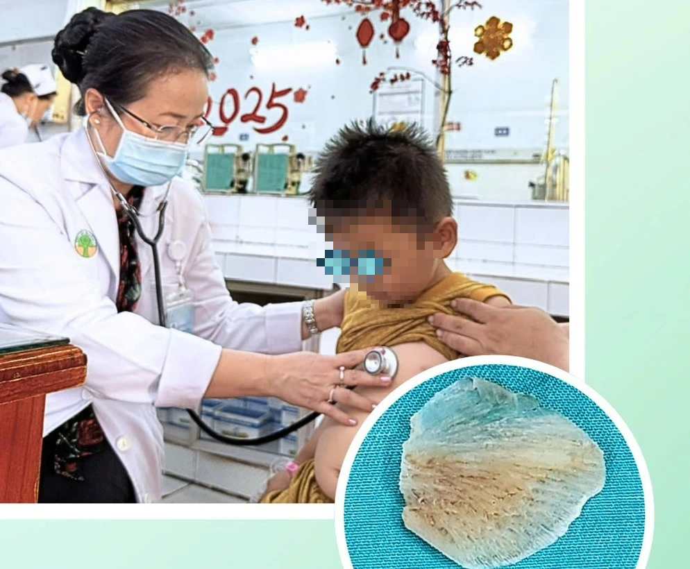 - Ảnh 1. Bác sĩ cảnh báo nhiều trẻ uống nhầm hóa chất, hóc xương cá - Ảnh 1.
