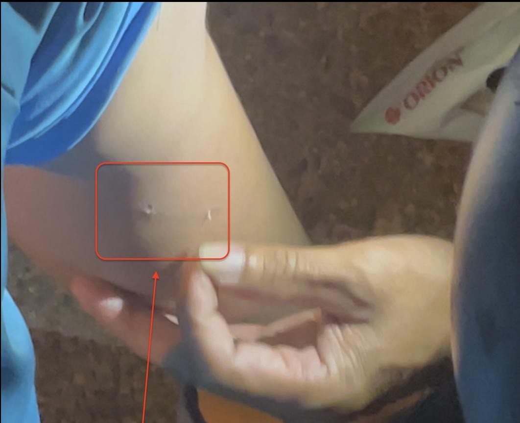 Đà Nẵng: Một trẻ em bị bò thả rông húc văng- Ảnh 3. Đà Nẵng: Một trẻ em bị bò thả rông húc văng- Ảnh 3.