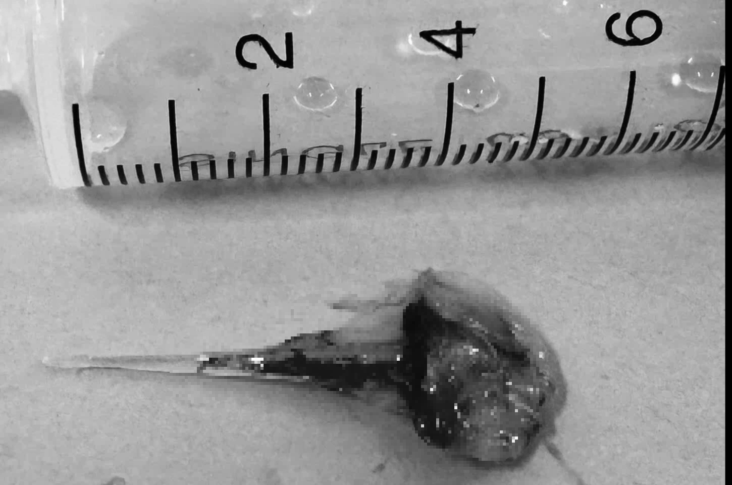 Ho nhiều ngày, đi khám phát hiện xương cá dài 6 cm trong phế quản Ho nhiều ngày, đi khám phát hiện mảnh xương cá dài 6 cm trong phế quản - Ảnh 1.