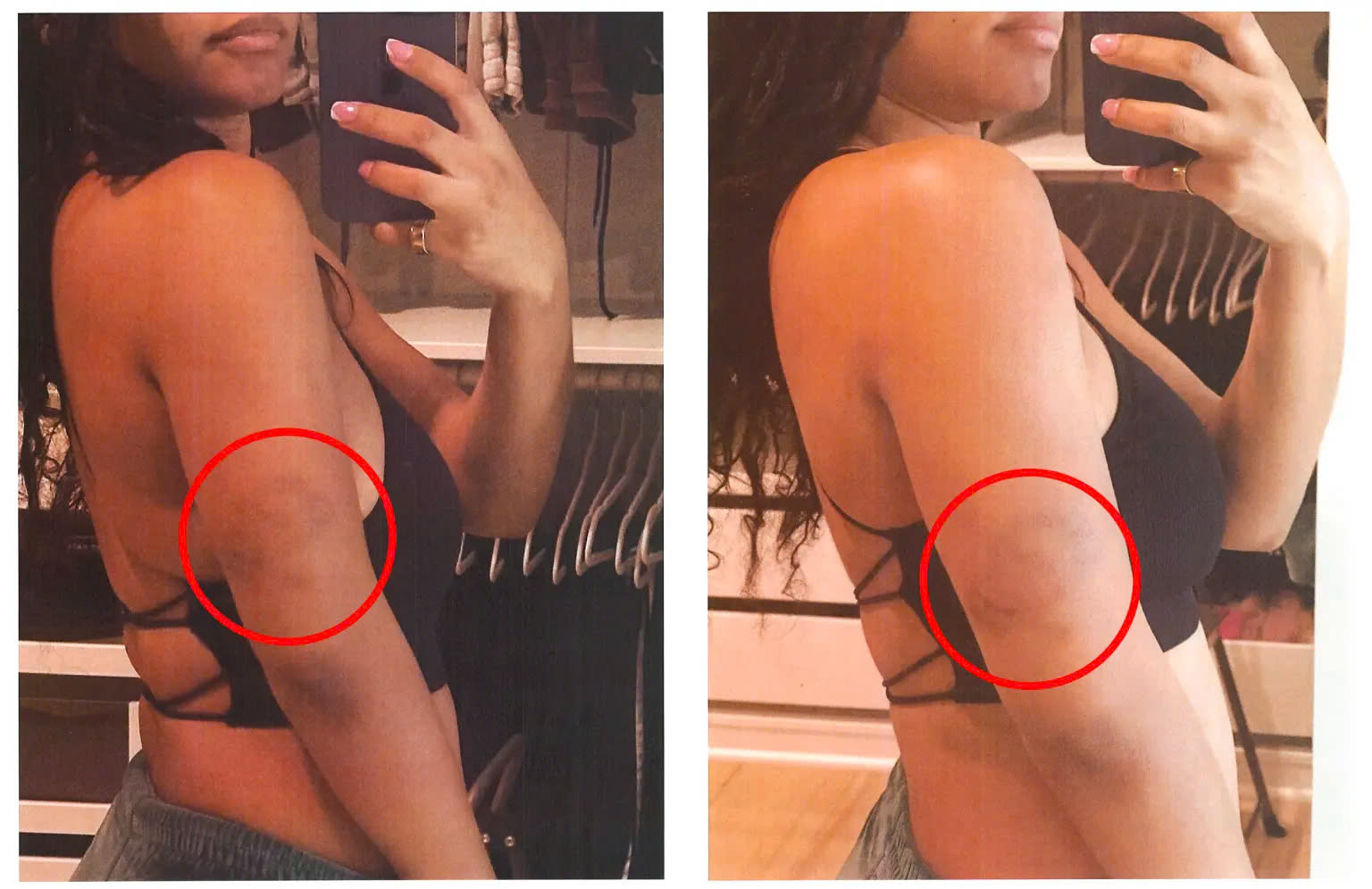 'Nàng tiên cá' Halle Bailey bị người yêu cũ bạo hành - Ảnh 1.