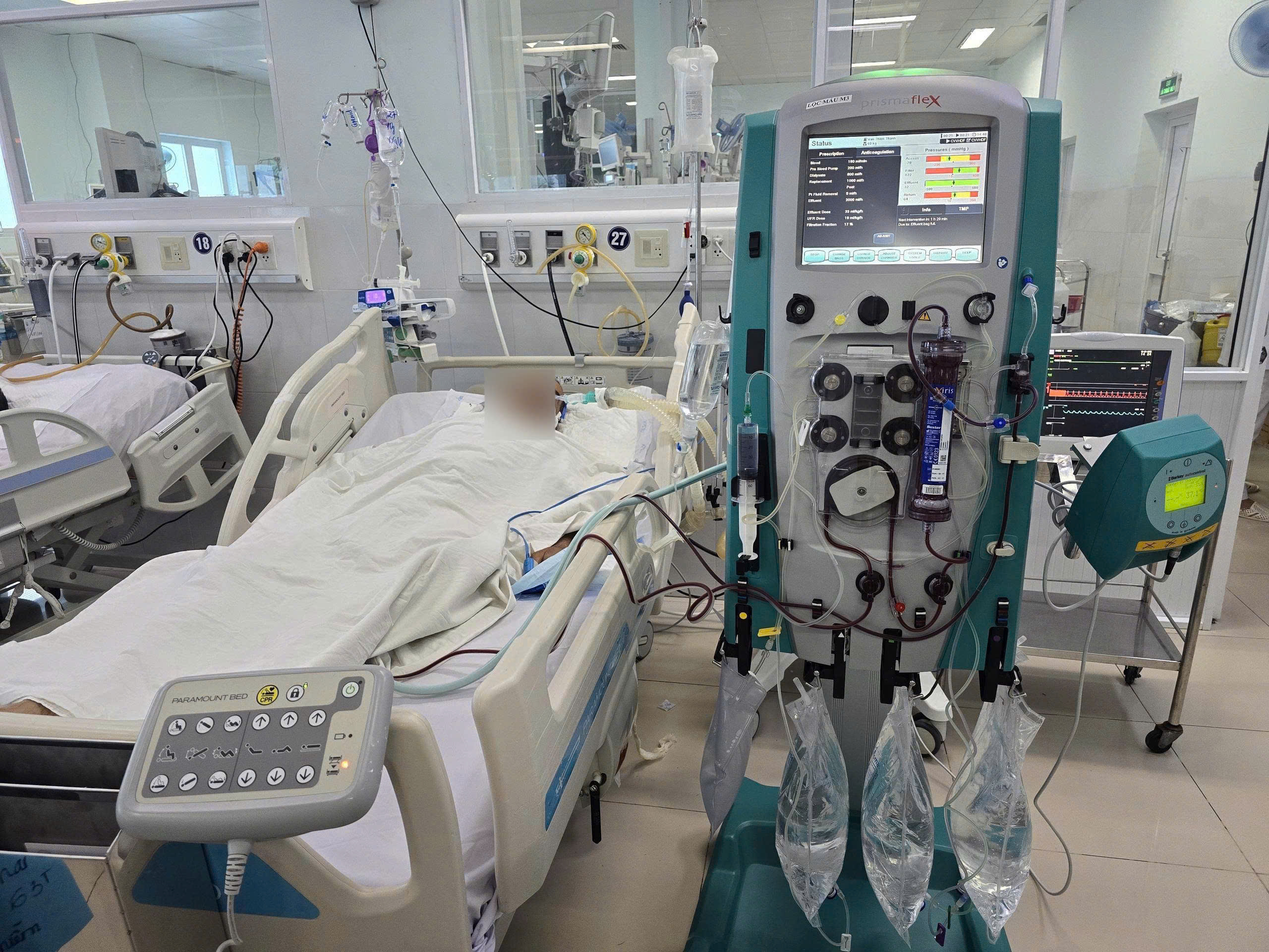 Cứu sống bệnh nhân bị viêm mô bào gây biến chứng suy đa tạng Thoát 'cửa tử' nhờ điều trị kịp thời viêm mô bào biến chứng suy đa tạng - Ảnh 2.