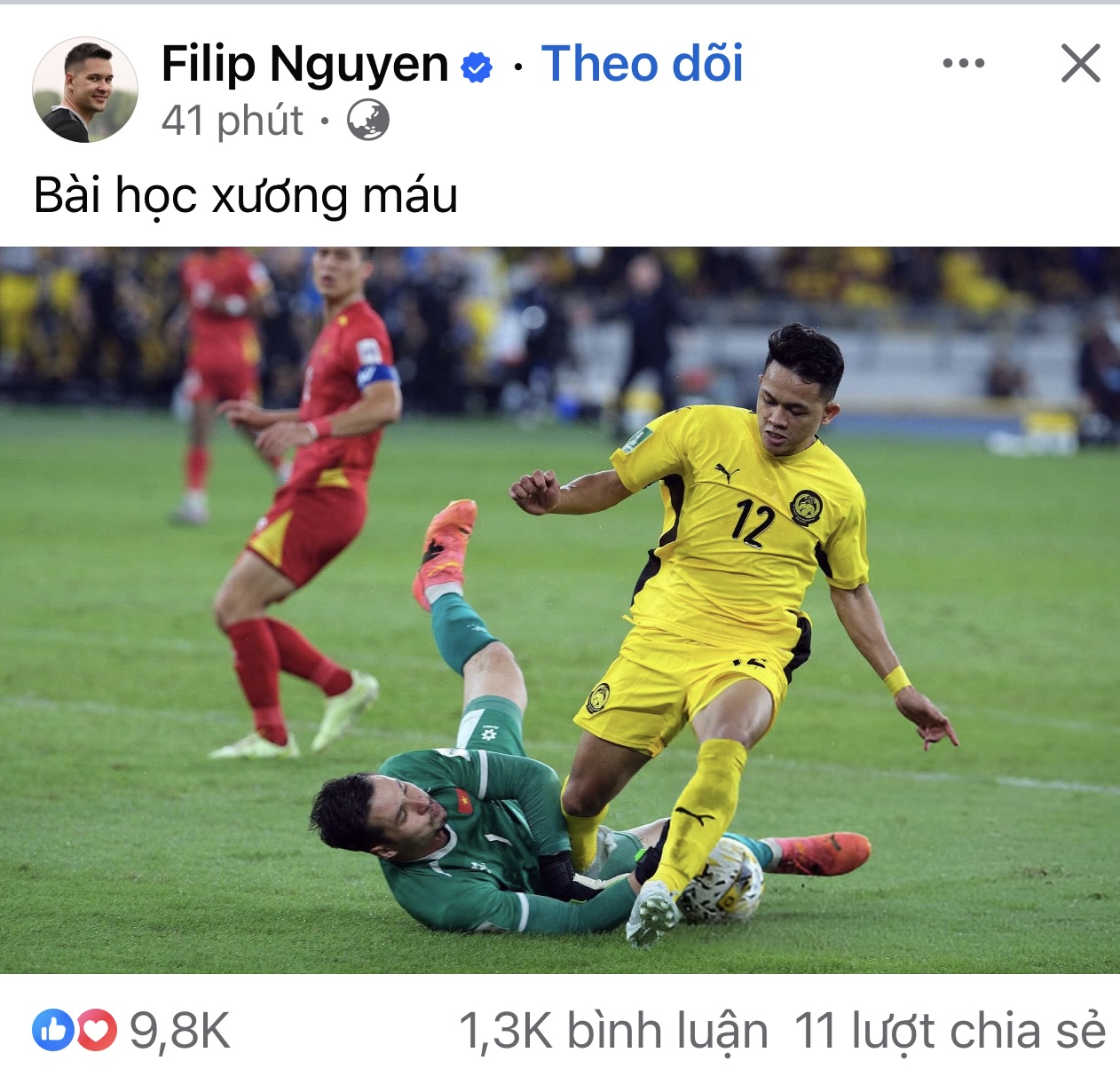 Nguyen Filip さんは、「痛い教訓だ!」というコメントを投稿した後、多くの反響を呼びました。 - 写真 2。 Nguyễn Filip nhận lượng tương tác ‘khủng’ sau dòng cảm thán: Bài học xương máu!- Ảnh 2.