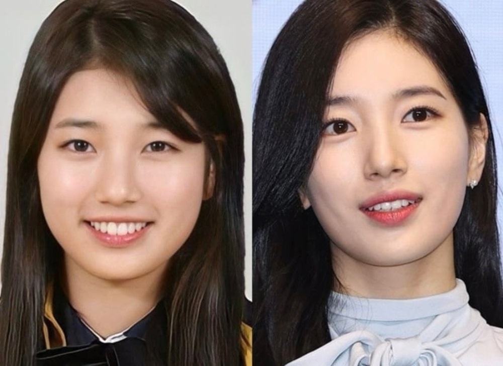 Image hình ảnh hình ảnh hình ảnh hình ảnh hình ảnh hình ảnh Suzy - Sự thay đổi ngoại hình của Suzy gây tò mò