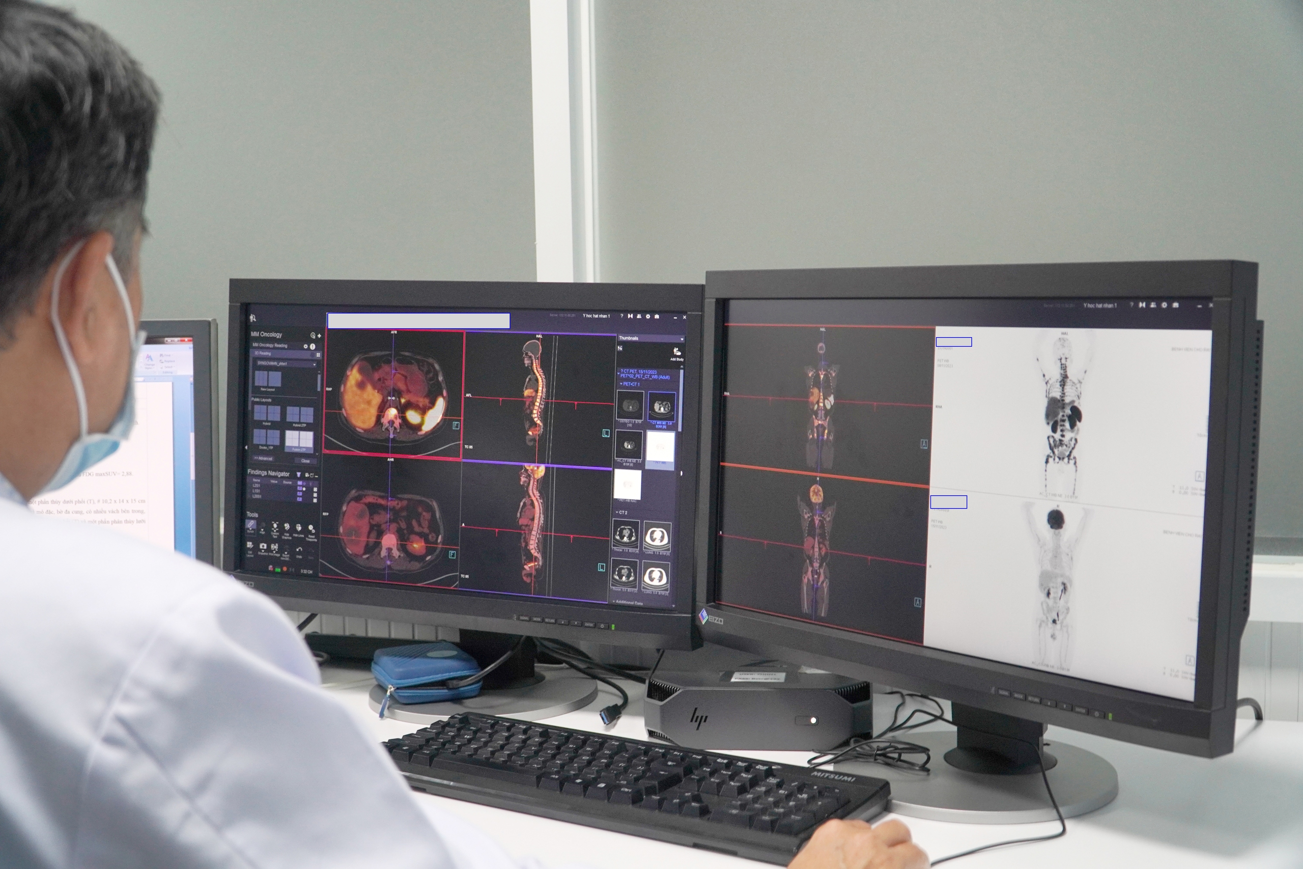Bệnh viện Chợ Rẫy nói về dừng lò sản xuất phóng xạ dùng cho máy PET-CT - Ảnh 3.