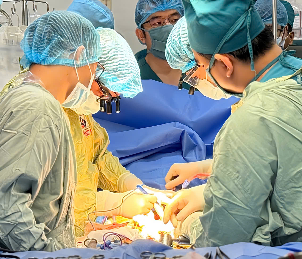 Bệnh viện Nhân dân Gia Định: Trắng đêm hồi sinh 3 sự sống từ người hiến tạng - Ảnh 3.