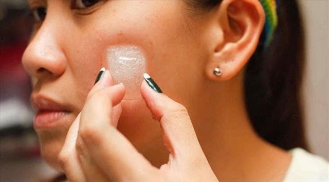 Bật mí 11 cách trị mụn nhanh, đơn giản tại nhà, ít tốn kém mà hiệu quả- Ảnh 4.
