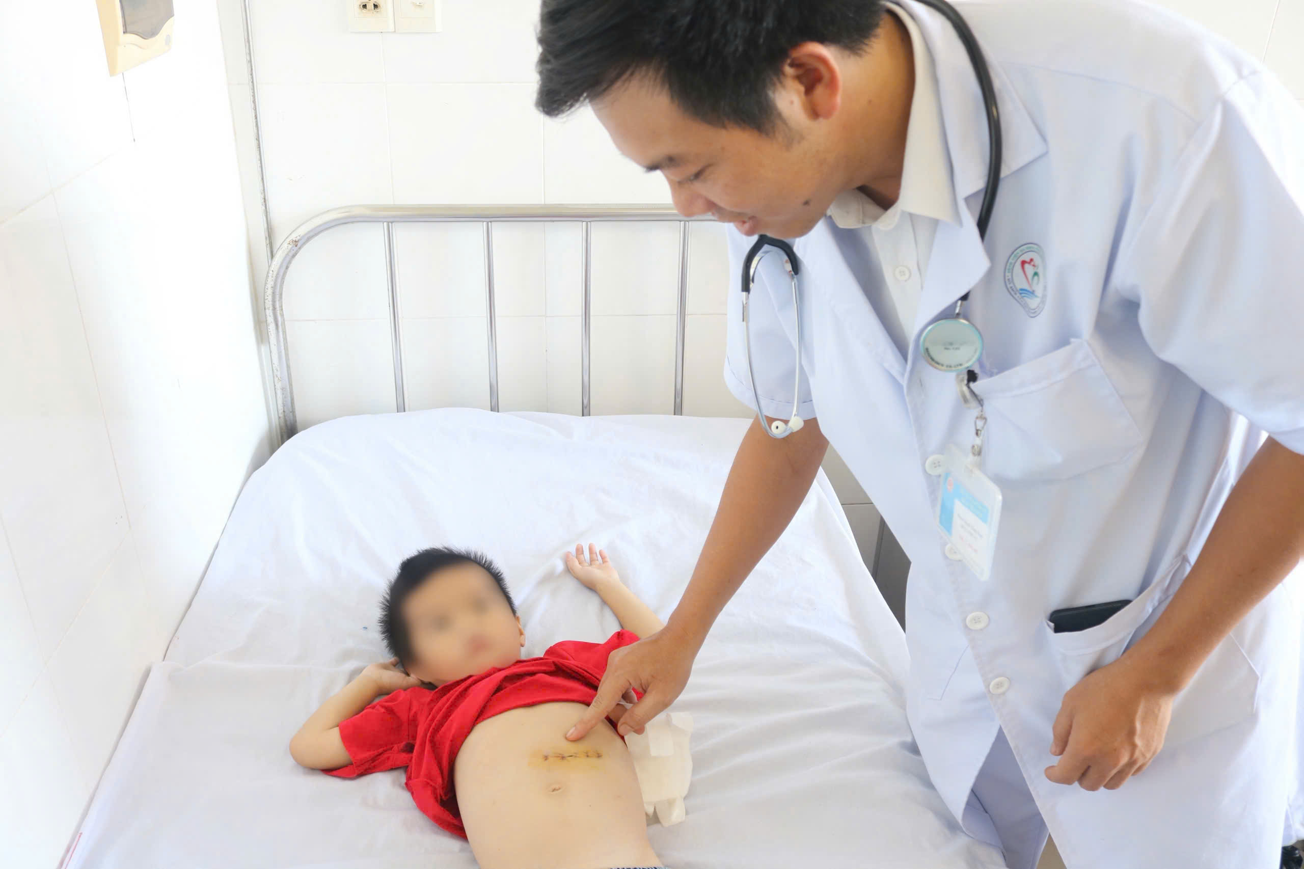Búi tóc nặng 0,5 kg trong dạ dày của bệnh nhi 5 tuổi - Ảnh 2.