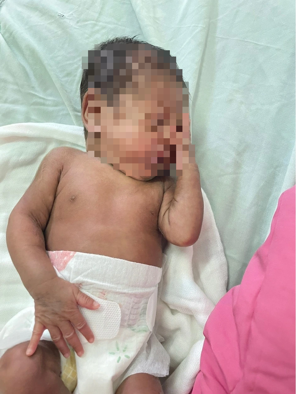 Kỳ tích cứu sống trẻ sơ sinh 700 gram sinh non tại khánh hòa - Ảnh 2. Kỳ tích cứu sống trẻ sơ sinh 700 gram sinh non tại khánh hòa - Ảnh 2.