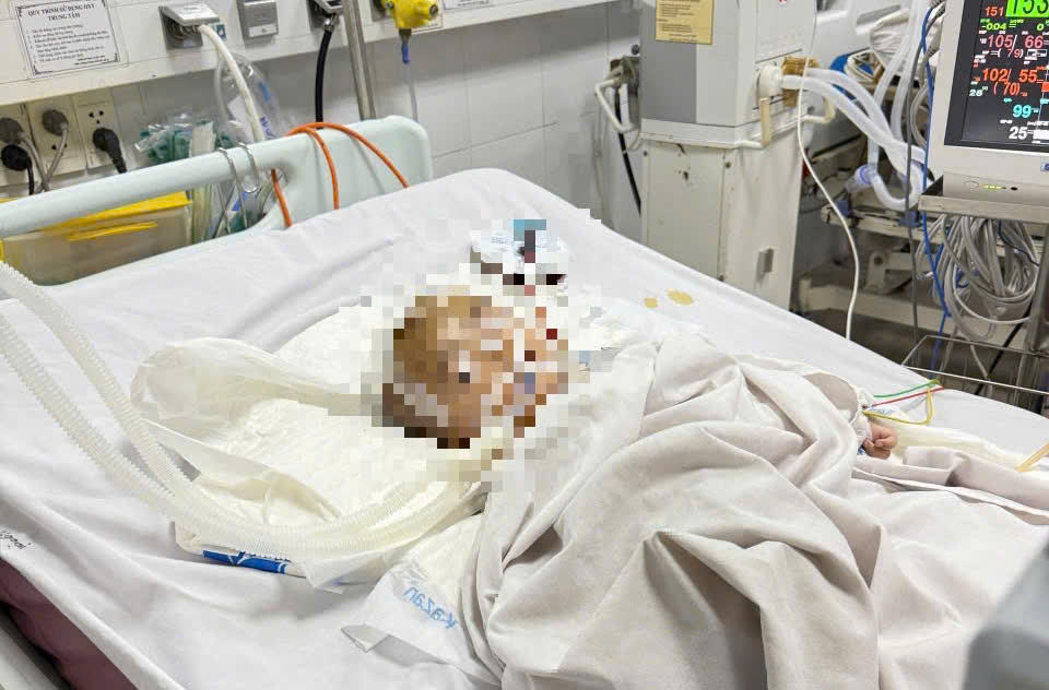 Bé trai bị xuất huyết não ở nhóm trẻ tự phát, công an vào cuộc điều tra - Ảnh 1. Bé trai bị xuất huyết não ở nhóm trẻ tự phát, công an vào cuộc điều tra - Ảnh 1.