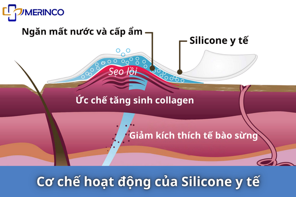 Sẹo lồi hay ngứa do đâu? Có trị hết được không?- Ảnh 2. Sẹo lồi hay ngứa do đâu? Có trị hết được không?- Ảnh 2.