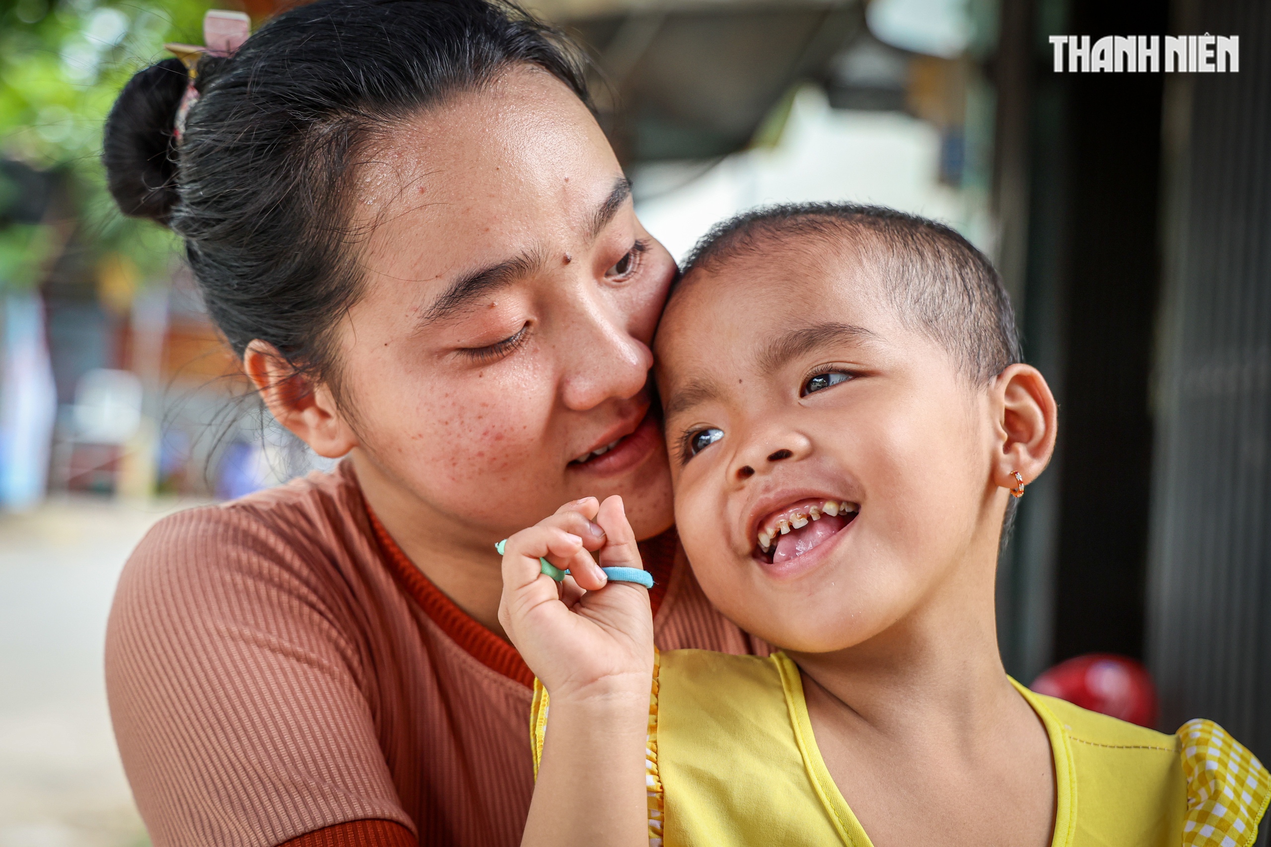 Bé gái ung thư nguy cơ bỏ mắt vì hết tiền chữa, được giúp 210 triệu đồng - Ảnh 1.