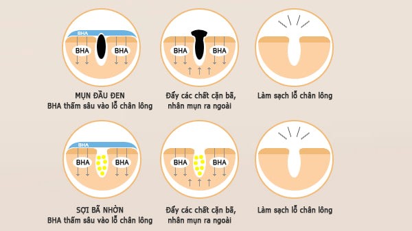 BHA l&agrave; g&igrave;? V&igrave; sao trở th&agrave;nh ng&ocirc;i sao trong c&aacute;c sản phẩm trị mụn? - Ảnh 4.