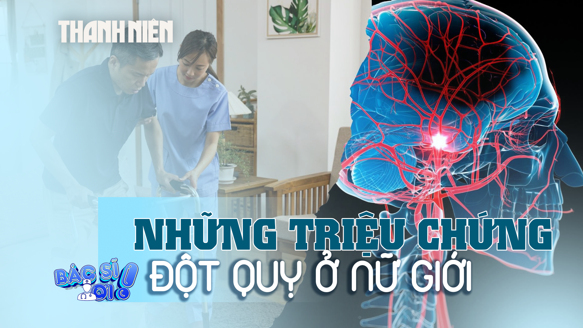 Đột quỵ ở nữ giới, dễ bỏ qua những triệu chứng - Ảnh 1.