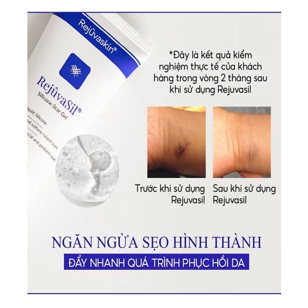 Cách ngừa sẹo và trị sẹo chuẩn y khoa hiệu quả tại nhà không cần xâm lấn Cách ngừa sẹo và trị sẹo chuẩn y khoa hiệu quả tại nhà không cần xâm lấn