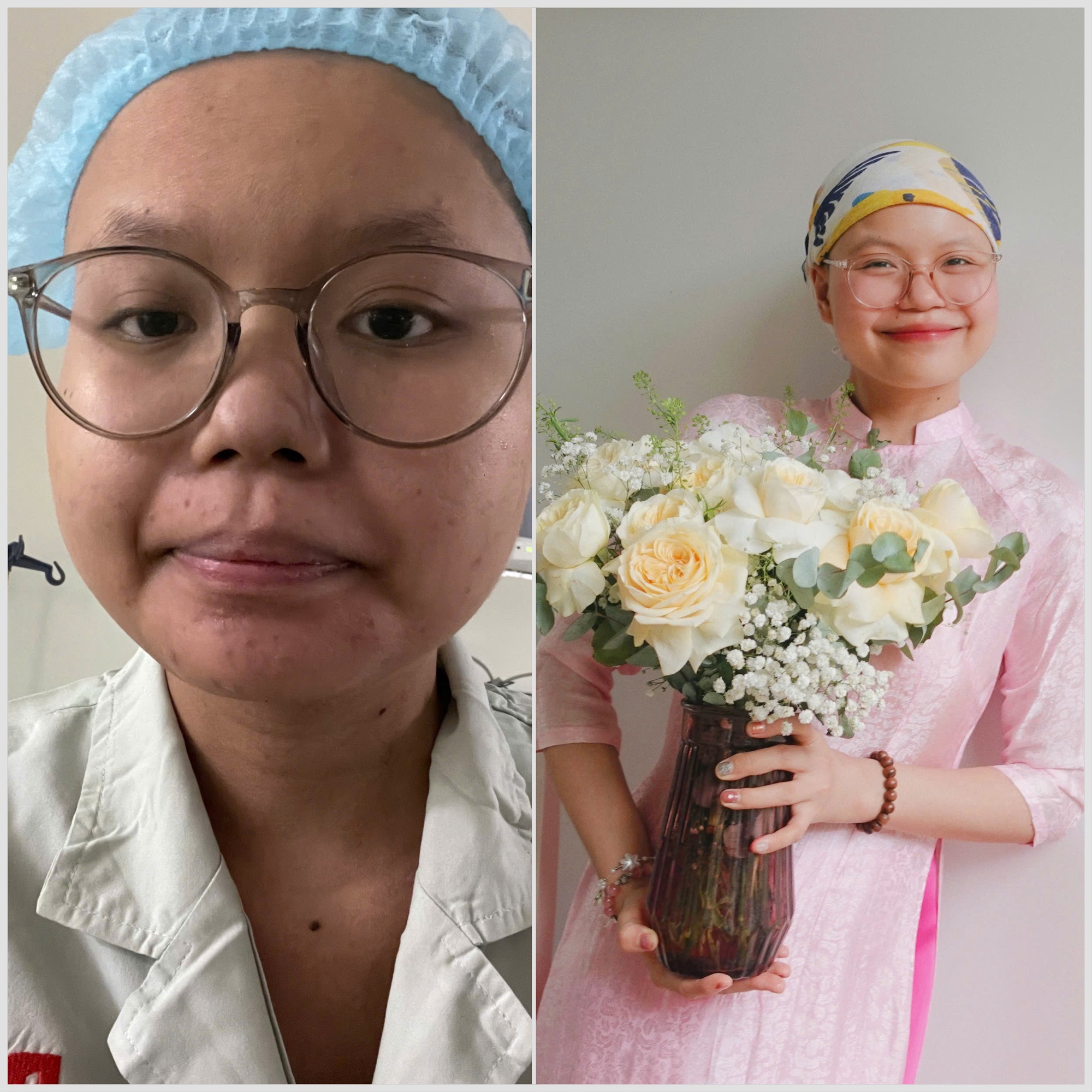 Nụ cười rạng rỡ của nữ sinh viên ung thư Phương Thảo tại lễ tốt nghiệp - Ảnh 3.
