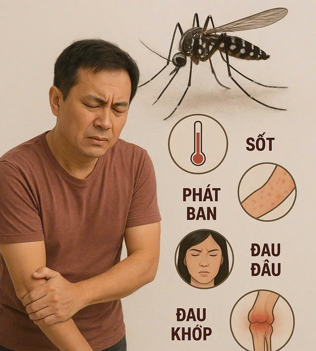 Virus chikungunya gây bệnh 'người đi khom lưng'- Ảnh 1. Virus chikungunya gây bệnh 'người đi khom lưng'- Ảnh 1.
