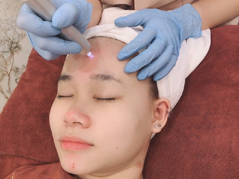 Hỗ trợ phục hồi da sau laser và phun xăm