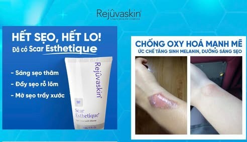 Sẹo lâu năm hay cứng đầu đến mấy cũng mờ hẳn nhờ kem trị sẹo này- Ảnh 1.