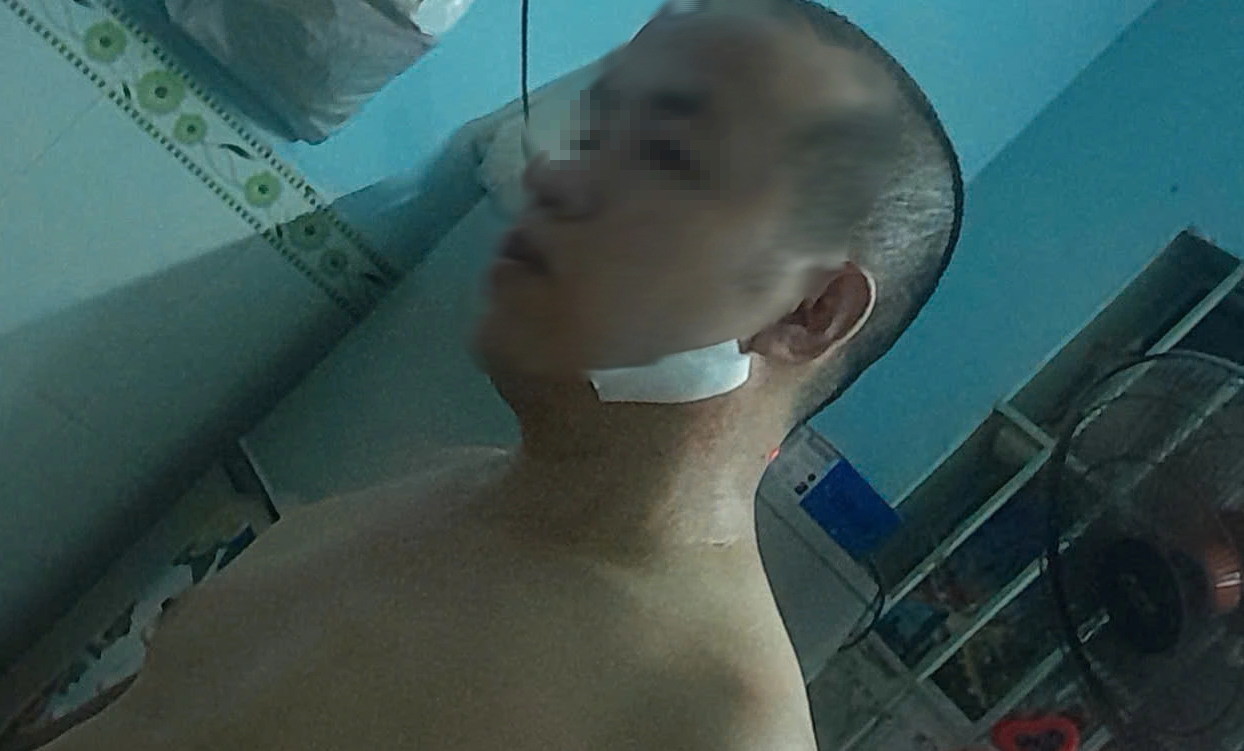 TP.HCM: Vợ chồng công nhân bị đạp xe, hành hung dã man sau ca làm đêm- Ảnh 2.