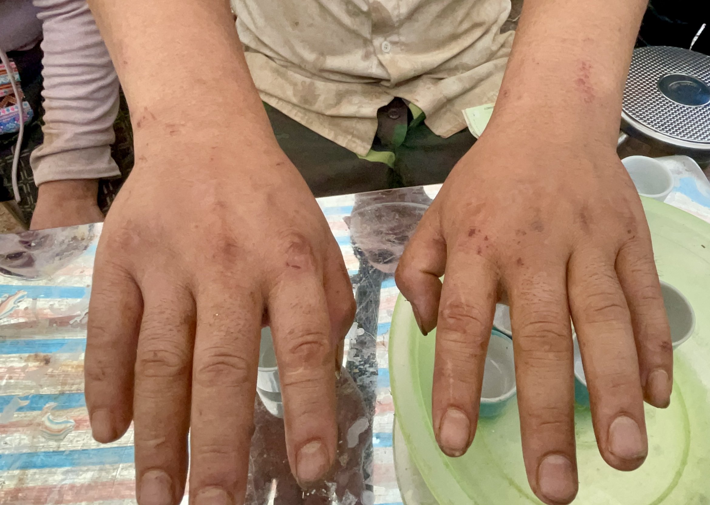 Người bố thoát chết kể khoảnh khắc bất lực nhìn 3 con bị vùi lấp trong bùn đất- Ảnh 4.