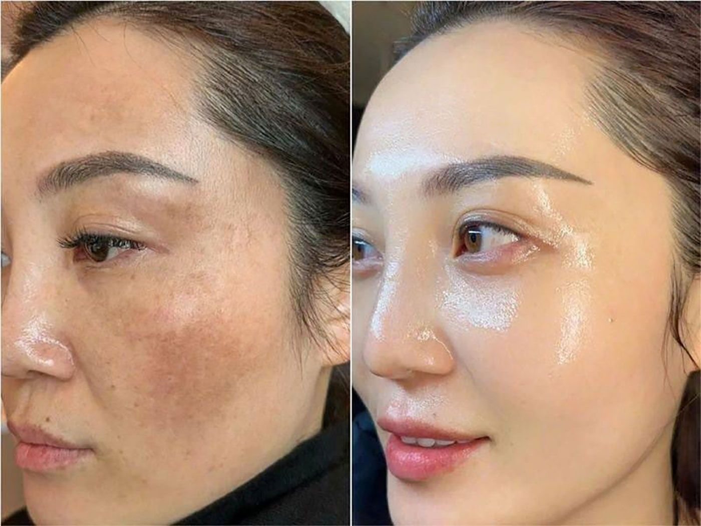 Top 3 Retinol cứ bôi da bật chế độ tươi trẻ, tuổi tác chỉ là con số- Ảnh 1.