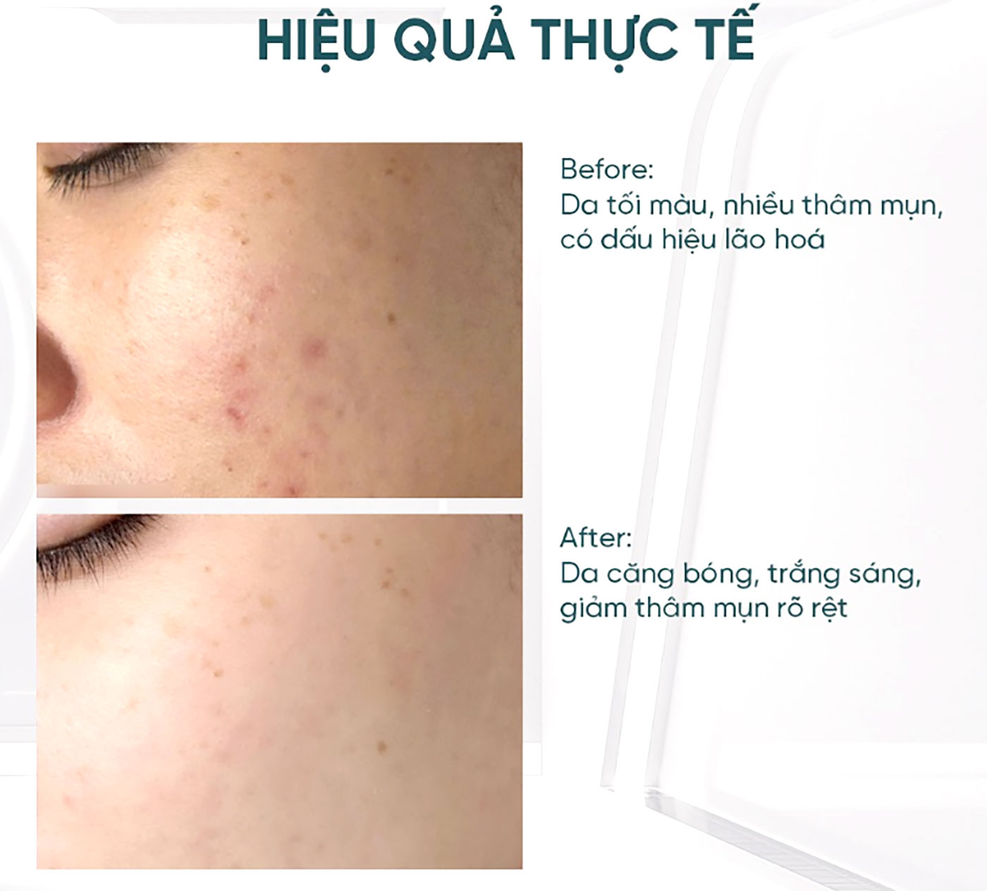 3 hudblekende antialdringsserum som hjelper kvinner over 30 med å «hacke alderen». Kjøp dem så snart de kommer i hyllene – Bilde 2. 3 serum trắng da, chống lão hóa giúp nàng 30+ ‘hack tuổi’, lên kệ là mua luôn- Ảnh 2.