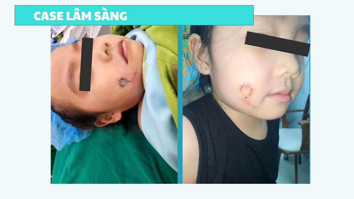 - Fotoğraf 4.  - Ảnh 4.