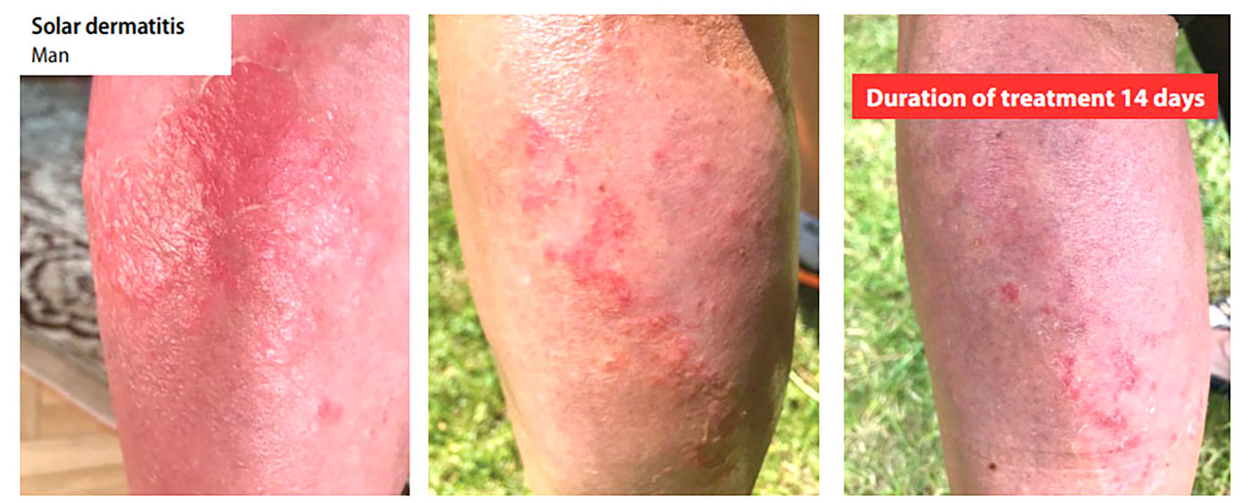 - Fotoğraf 5.  - Ảnh 5.