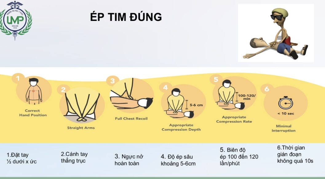 Dấu hiệu cảnh báo biến cố ngừng tim - Ảnh 1.