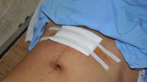 - Ảnh 4. - Ảnh 4.