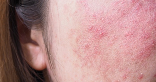 Góc cảnh báo: 3 dấu hiệu nhận biết ngay "hàm lượng collagen" đang thất thoát từng giờ - Ảnh 2.