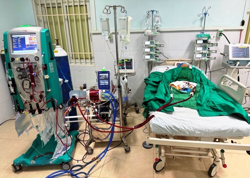 Đà Nẵng: Bệnh Viện Tuyến Cơ Sở Cứu Bệnh Nhân Sốc Tim Nguy Kịch Nhờ Va-Ecmo - Ảnh 1.