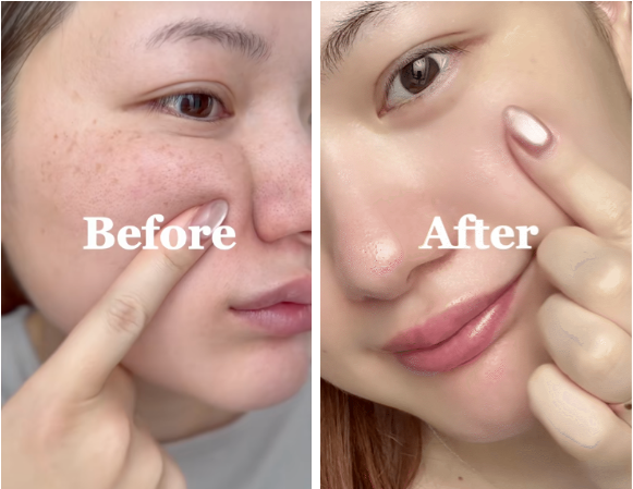 Top 7 serum l&agrave;m mờ n&aacute;m đậm, n&aacute;m s&acirc;u tới đ&acirc;u cũng hiệu quả- Ảnh 1.