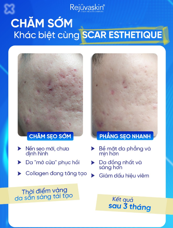 Hướng dẫn sử dụng kem l&agrave;m mờ sẹo rỗ Rejuvaskin Scar Esthetique đ&uacute;ng chuẩn y khoa - Ảnh 5.
