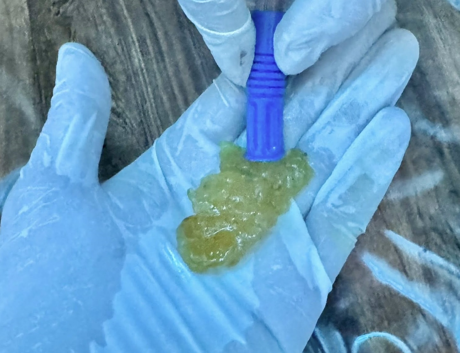 Tp.hcm: Sặc Bánh Trôi Nước Khiến Cụ Ông Hôn Mê, Ngưng Tim - Ảnh 3.