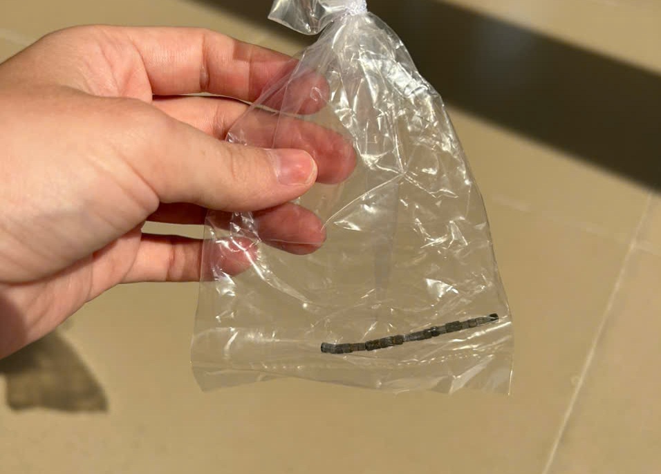 Bé Trai 2,5 Tuổi Bị Thủng Ruột 10 Lỗ, Nghi Các Viên Nam Châm Nhỏ Gây Ra. - Ảnh 1.