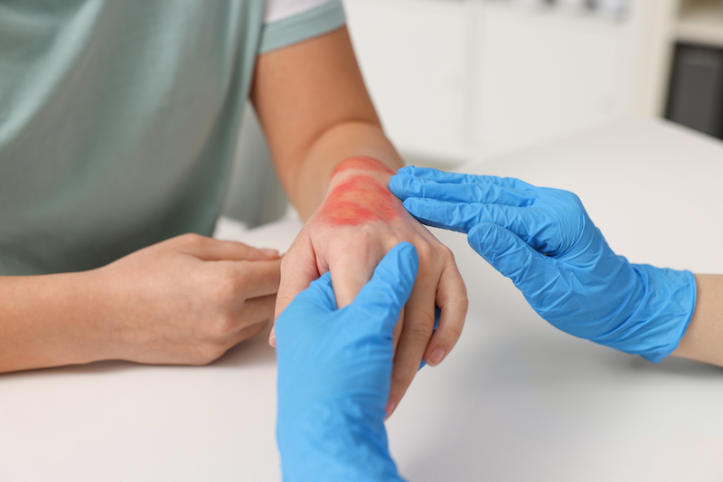 3 khoảng trống dễ bị bỏ qua trong chăm sóc hậu phẫu ảnh hưởng đến lành thương - Ảnh 3.
