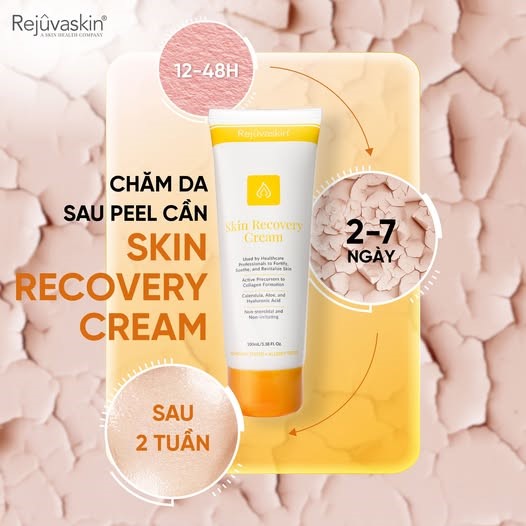 Cần làm gì sau khi peel da? Bất ngờ 99% đều làm sai khiến da tổn thương - Ảnh 5.