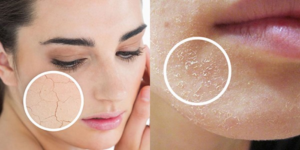 Càng rửa mặt da càng khô, xỉn màu: Có phải bạn mắc 5 sai lầm dưới đây? - Ảnh 3.