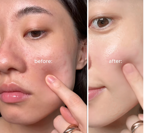 Da càng chăm càng già? Do bạn đang thiếu bước skincare retinol cho da lão hóa - Ảnh 1.