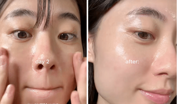 Da càng chăm càng già? Do bạn đang thiếu bước skincare retinol cho da lão hóa - Ảnh 3.