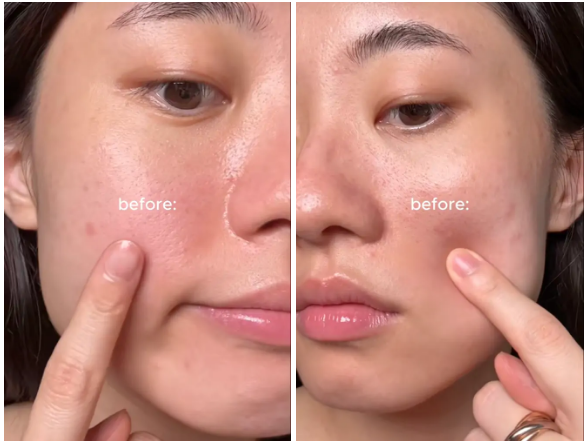 Da càng chăm càng già? Do bạn đang thiếu bước skincare retinol cho da lão hóa - Ảnh 5.