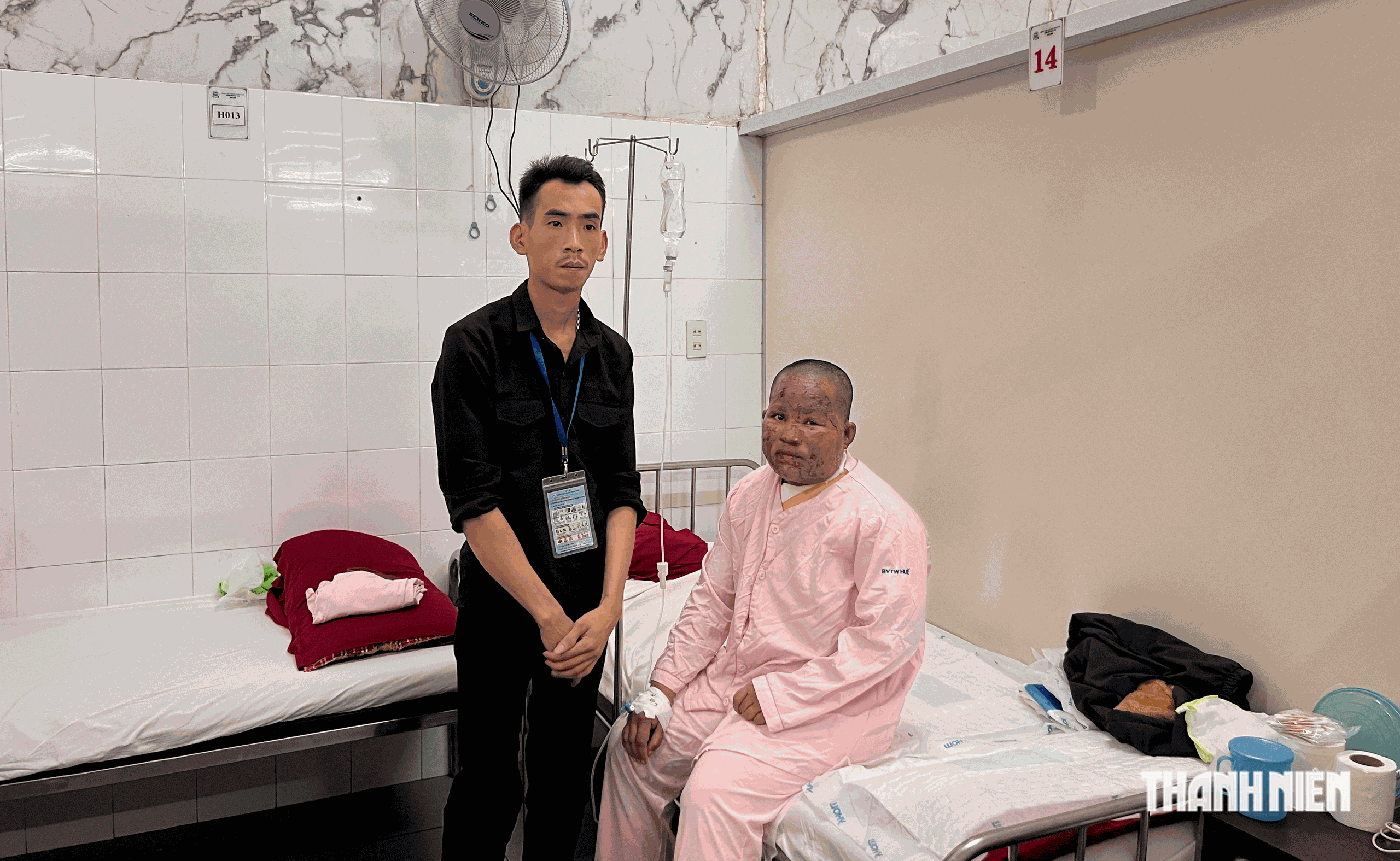 Sản phụ nghèo bị bỏng nặng sau sinh cần sự hỗ trợ của cộng đồng- Ảnh 1.