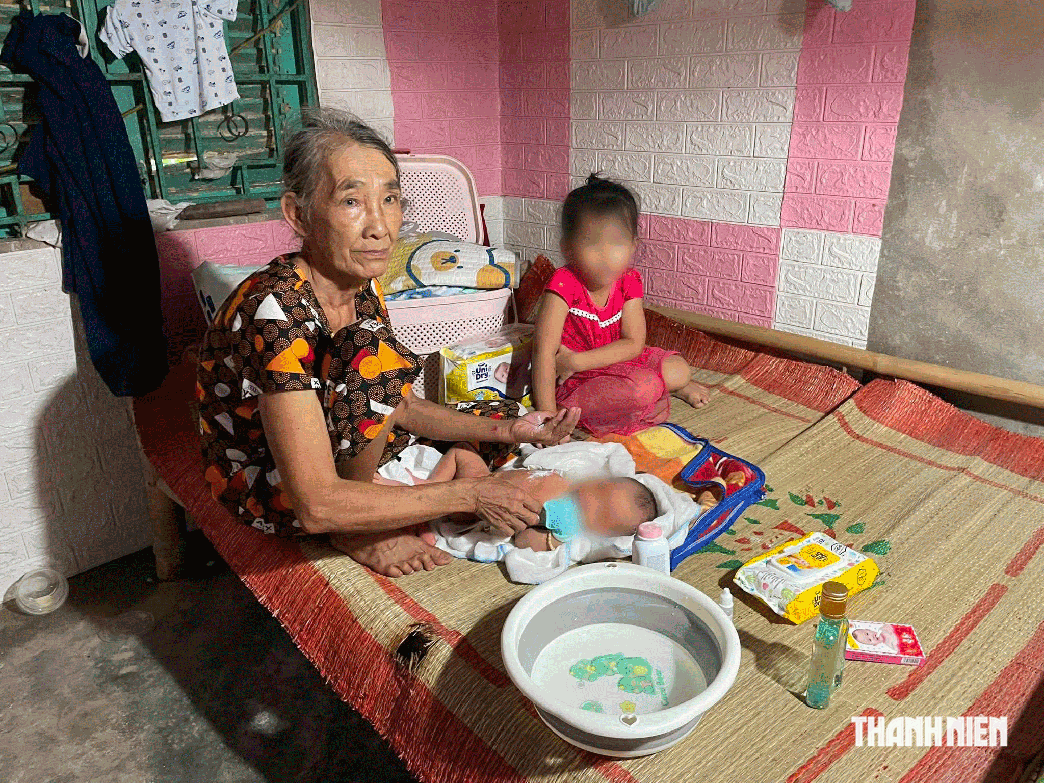 Sản phụ nghèo bị bỏng nặng sau sinh cần sự hỗ trợ của cộng đồng- Ảnh 2.