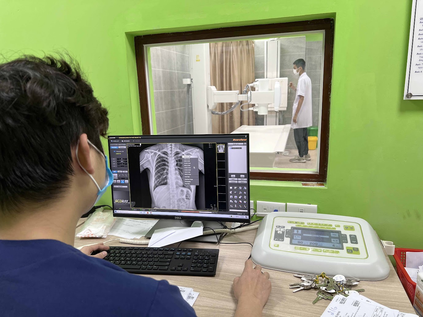 Chụp X-Quang Dưới 6 Phút Bhyt Không Thanh Toán: Bộ Y Tế Đề Nghị Điều Chỉnh - Ảnh 1.